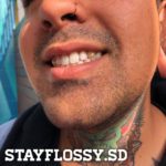tooth gems San Diego Stay Flossy